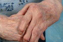 2019 08 30 17 41 8664 Hands Arthritis2 400