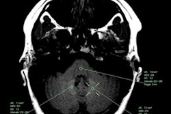 2019 09 09 21 43 4464 2019 09 10 Gbca Signal Intensity Ms Patients 500 20190909212418