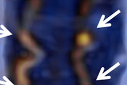 2019 09 12 17 38 1053 2019 09 06 Pet Mri