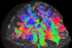 2019 09 25 17 36 6712 D Hcp Dwi Mri Kids Brain Scans 400