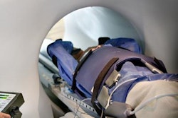 2019 09 26 17 08 1342 Medphysweb Radiotherapy View Ray Mr Idian 20190926174229