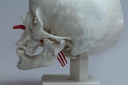 2019 10 02 18 20 4714 3 D Printed Head Fork 20191002180547