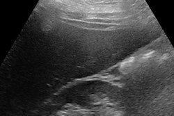 2019 10 10 21 09 1501 Steatose Fig 1c 20191010211612