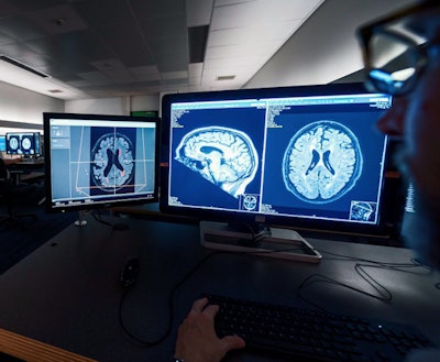 A neural network on Utrecht UMC's IMAGR AI system reveals white-matter hyperintensity for dementia questions from brain MRI. Image courtesy of Olivier Middendorp - NRC.