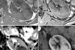 2019 10 18 17 51 6791 Grenier Thumb