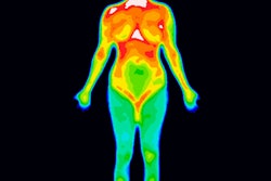 2019 10 23 22 27 6008 Thermography 400