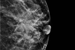 2019 10 25 17 57 6815 Ceugnart 1b 400 Thumb2