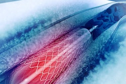 2018 09 25 19 07 0563 Stent 400
