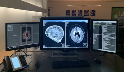 The IMAGR interface (left monitor) shows the results of the white-matter hyperintensity detection and quantification algorithm. The middle monitor shows the PACS interface. The right monitor shows the electronic health record. Image courtesy of Olivier Middendorp - NRC.
