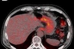 2019 11 06 22 27 7331 Esophageal Images Jnm Valkema 400