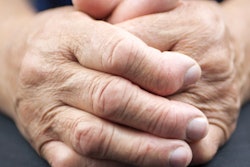 2019 11 11 17 21 4628 Hands Arthritis Rheumatoid 400