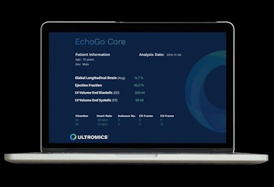 EchoGo Core is designed to enable the earlier detection of cardiovascular disease. Image courtesy of Ultromics.
