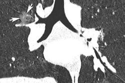 2019 11 20 20 30 2488 Swiss Pe Pic1 20191120202253