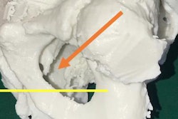 2019 11 25 22 20 6195 3 D Printed Pelvis Lateral Cropped 20191125223515