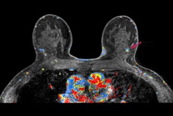 2019 11 27 20 45 2576 Nejm Breast Mri 400