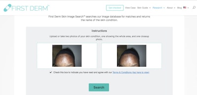 2019 11 27 21 00 8965 First Derm