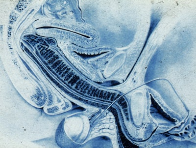 Image of coitus from the famous Dutch study of eight couples imaged by MRI during sexual intercourse. All clinical images courtesy of Dr. Pek van Andel.