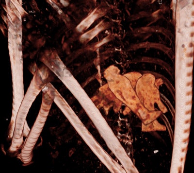 A 3D CT image shows the four sons of Horus within the chest of Ramses III. The head of each statue is depicted in the 3D reconstruction: a human, baboon, jackal, and falcon.