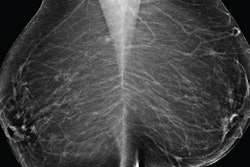 2019 12 01 20 30 3281 Halling Brown Ai Breat Rsna 20191201205911