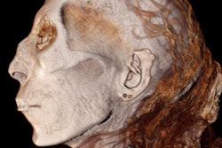 2019 12 02 19 15 6240 Mummy 3 D Ct Profile Thuya 400