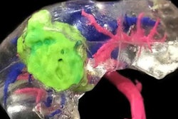 2019 12 13 17 46 7339 3 D Printing Liver 20191213173413