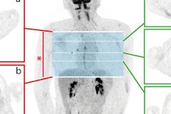 2019 12 13 22 48 9657 Ai Fdg Pet Lung 20191213225727