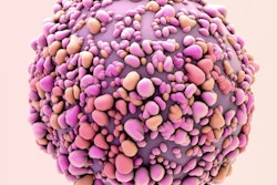 2020 01 03 17 45 4559 Breast Cancer Cell2 400
