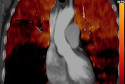 2020 01 10 22 38 9084 Ct Insider Fig 2 Total Marked 20200110225119