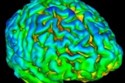 2020 01 15 18 46 0042 Pet Schizoprenia Nature Comm 250