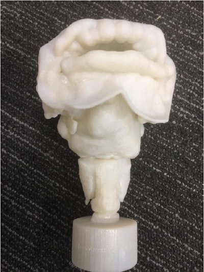 3D-printed vocal tract based on CT scans of Nesyamun's mummified body.