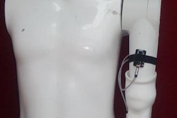 2020 01 24 17 48 1297 3 D Printed Prosthetic 20200124173021