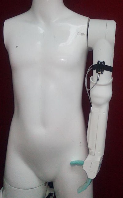 3D-printed prosthetic arm. Image courtesy of the University of Lincoln.