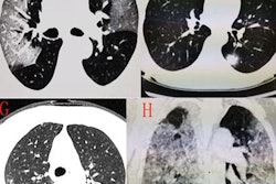 2020 02 10 23 36 1459 2020 02 10 Coronavirus Ct 20200210232241