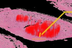 2020 02 13 19 51 3108 2020 02 14 Pathology 20200213191628