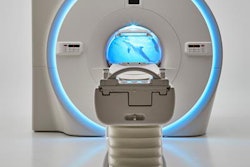 2020 02 24 23 26 0489 Canon Vantage Galan 3 T Mri 20200224230857