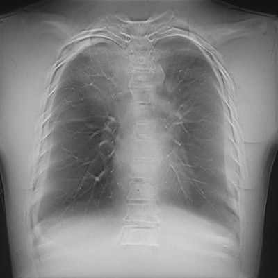 Digital tomosynthesis systems acquire a series of images to overcome the problem of overlapping structures. Image courtesy of Agfa HealthCare.