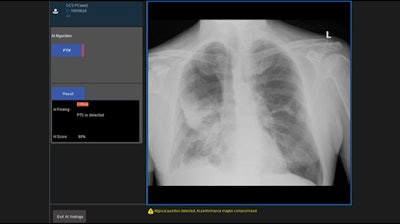 GE's Critical Care Suite is available on the Optima XR240amx mobile radiography system.