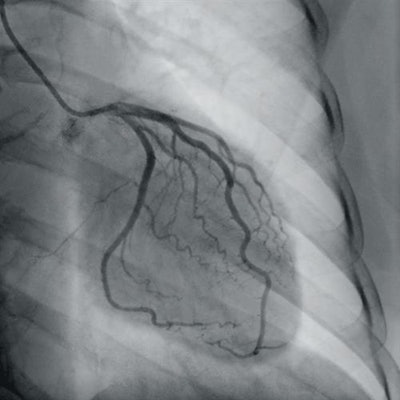 Ziehm has introduced C-arms based on complementary metal-oxide semiconductor technology.