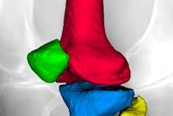 2020 03 16 21 48 2410 Rsip Vision 3 D X Ray 400