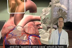 2020 03 17 17 00 4199 2020 03 17 Ar Heart 20200317172943