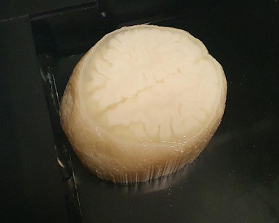 3D-printed brain model based on MR images. Image courtesy of Robin Holmes, PhD.