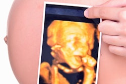 2019 10 11 17 46 9158 Pregnant Ultrasound 400