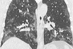 2020 04 01 23 56 4712 Esr Webinar Slide2 20200401231805