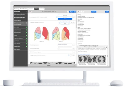 The plan is to update the COVID template regularly and translate it into other languages.