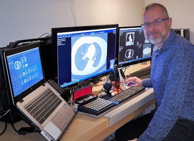 Mjöman working from home. Image courtesy of Sectra.