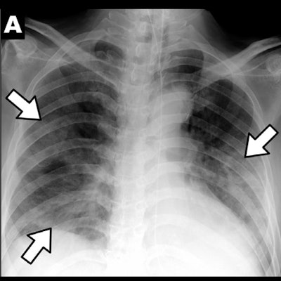 2020 05 07 15 41 2223 2020 04 02 Digital X Ray Insider Images (a)