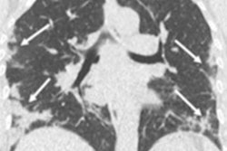 2020 05 08 22 27 8356 2020 04 23 Ldct Covid Figure 1 20200508222813