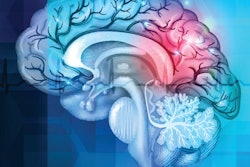 2020 05 20 16 37 3471 Brain Abstract 400