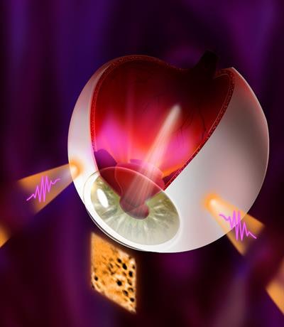 Illuminating retinal layers provided as transscleral illumination. Image courtesy of Timothé Laforest.