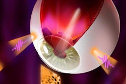 2020 05 22 18 51 4514 2020 05 22 Transscleral Optical Phase Imaging 20200522182457